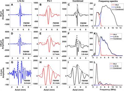 Wideband photoacoustic imaging in vivo with complementary frequency conventional ultrasound transducers